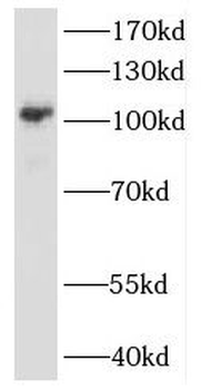 HNRNPUL1 Rabbit Polyclonal Antibody