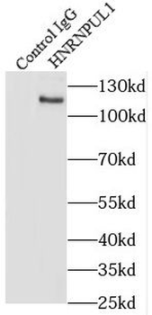 HNRNPUL1 Rabbit Polyclonal Antibody