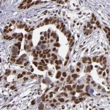 HNRNPUL1 Rabbit Polyclonal Antibody