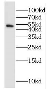 HOMER1 Rabbit Polyclonal Antibody