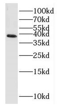 HOMER2 Rabbit Polyclonal Antibody
