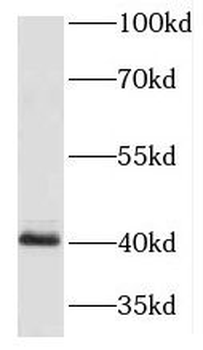 HOXA9 Rabbit Polyclonal Antibody
