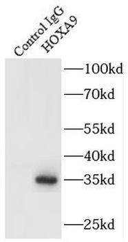 HOXA9 Rabbit Polyclonal Antibody