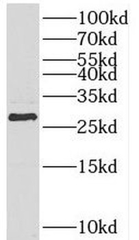HOXB7 Rabbit Polyclonal Antibody