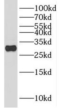 HOXC4 Rabbit Polyclonal Antibody