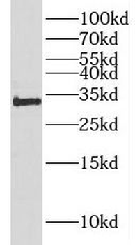 HOXC8 Rabbit Polyclonal Antibody