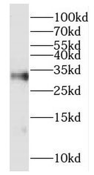 HOXD8 Rabbit Polyclonal Antibody