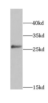 HPGD Rabbit Polyclonal Antibody