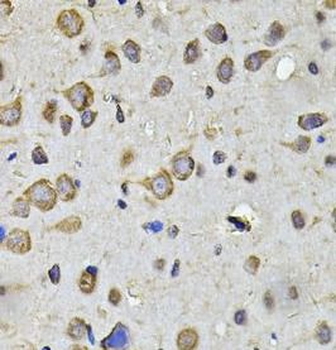 HPGD Rabbit Polyclonal Antibody