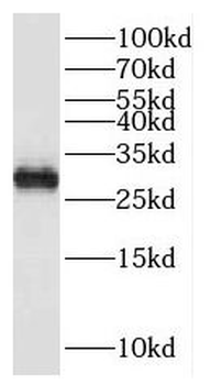 HPGDS Antibody