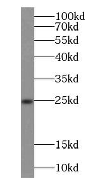 HPRT1 Rabbit Polyclonal Antibody