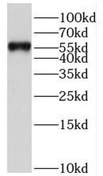 HRH1 Rabbit Polyclonal Antibody