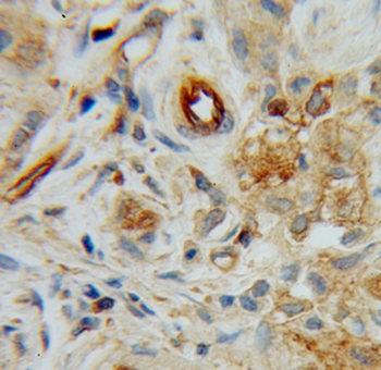 HRH1 Rabbit Polyclonal Antibody