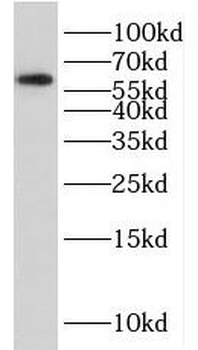 CDC73 Rabbit Polyclonal Antibody