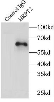 CDC73 Rabbit Polyclonal Antibody