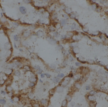 HSD11B2 Rabbit Polyclonal Antibody