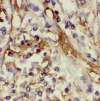 HSD17B6 Rabbit Polyclonal Antibody