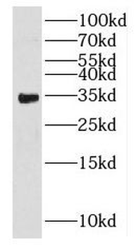 HSD17B8 Antibody
