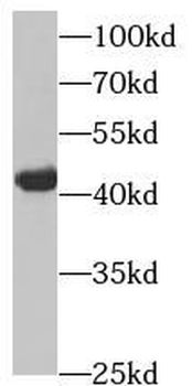 HSDL2 Antibody