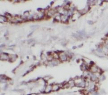 HSPD1 Antibody