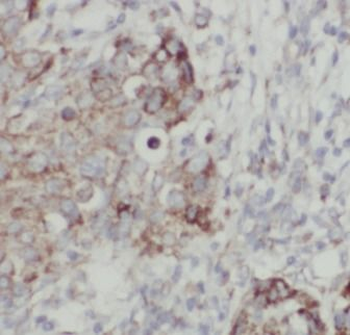 HSPA4 Antibody