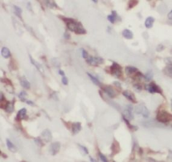 HSPA6 Rabbit Polyclonal Antibody