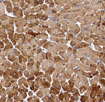 HSPB2 Antibody