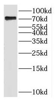 TRMT2A Rabbit Polyclonal Antibody