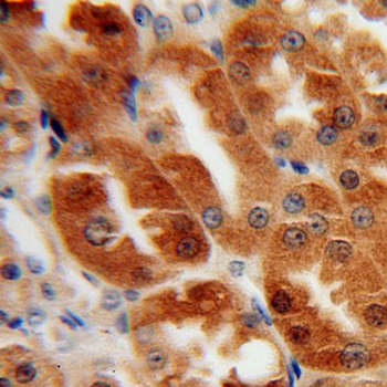TRMT2A Rabbit Polyclonal Antibody
