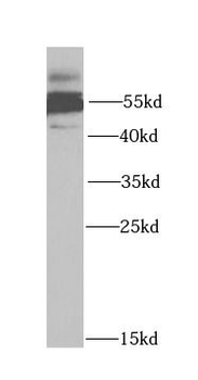 HTR3A Rabbit Polyclonal Antibody
