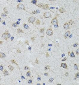 HTR3A Rabbit Polyclonal Antibody