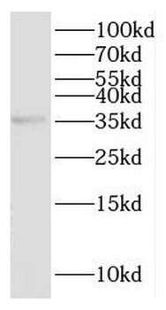 HTRA1 Rabbit Polyclonal Antibody