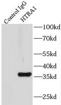 HTRA1 Rabbit Polyclonal Antibody