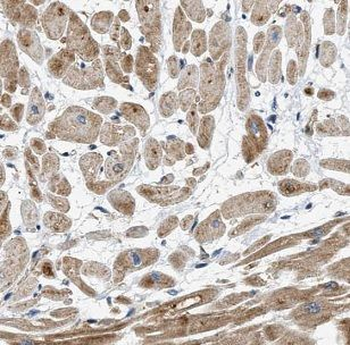 MT RNR2 Rabbit Polyclonal Antibody