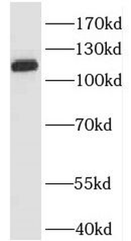 IARS2 Rabbit Polyclonal Antibody