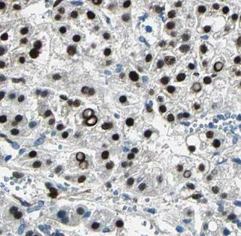 IARS2 Rabbit Polyclonal Antibody