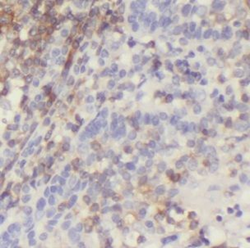 ICAM1 Mouse Monoclonal Antibody