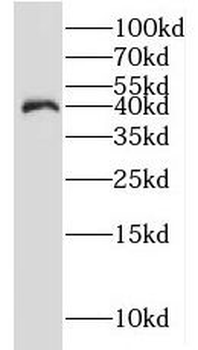IDH3A Rabbit Polyclonal Antibody