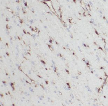 IDH3A Rabbit Polyclonal Antibody