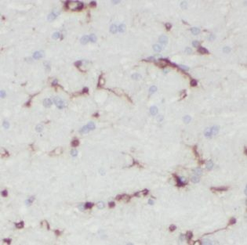 IDH3G Antibody
