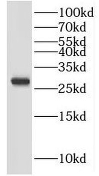 IDI1 Rabbit Polyclonal Antibody
