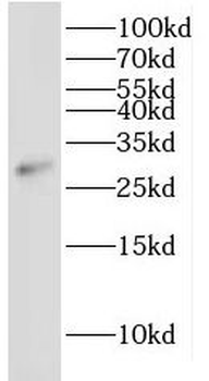 IDI2 Rabbit Polyclonal Antibody