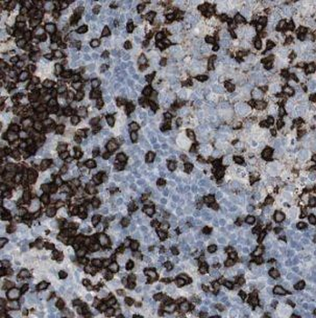 IFITM1 Rabbit Polyclonal Antibody
