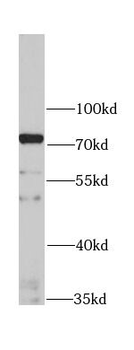 IFNAR1 Antibody