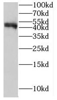 IFT57 Antibody