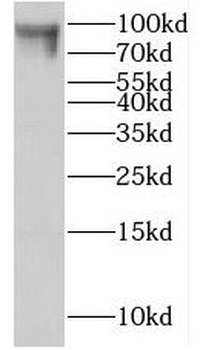 IFT80 Rabbit Polyclonal Antibody