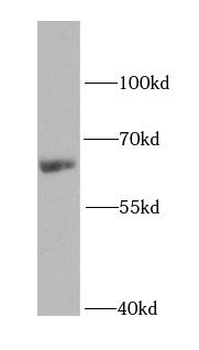 IGF2BP2 Antibody