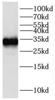 IGFBP2 Antibody