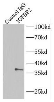 IGFBP2 Antibody