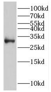 IGFBP7 Antibody